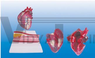 The model of heart coronary arching attach with artery